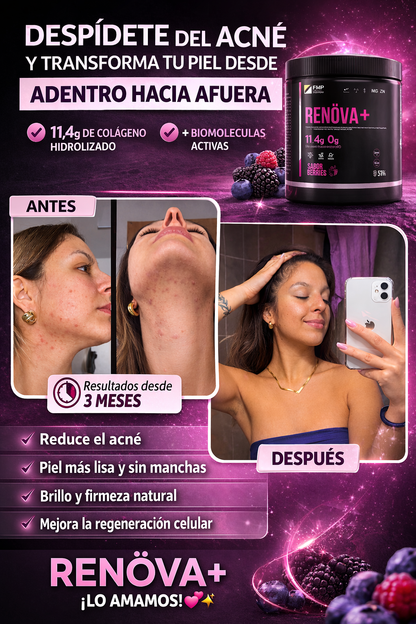 COLÁGENO RENÖVA+ — Nutre tu bienestar y realza tu belleza desde adentro.
