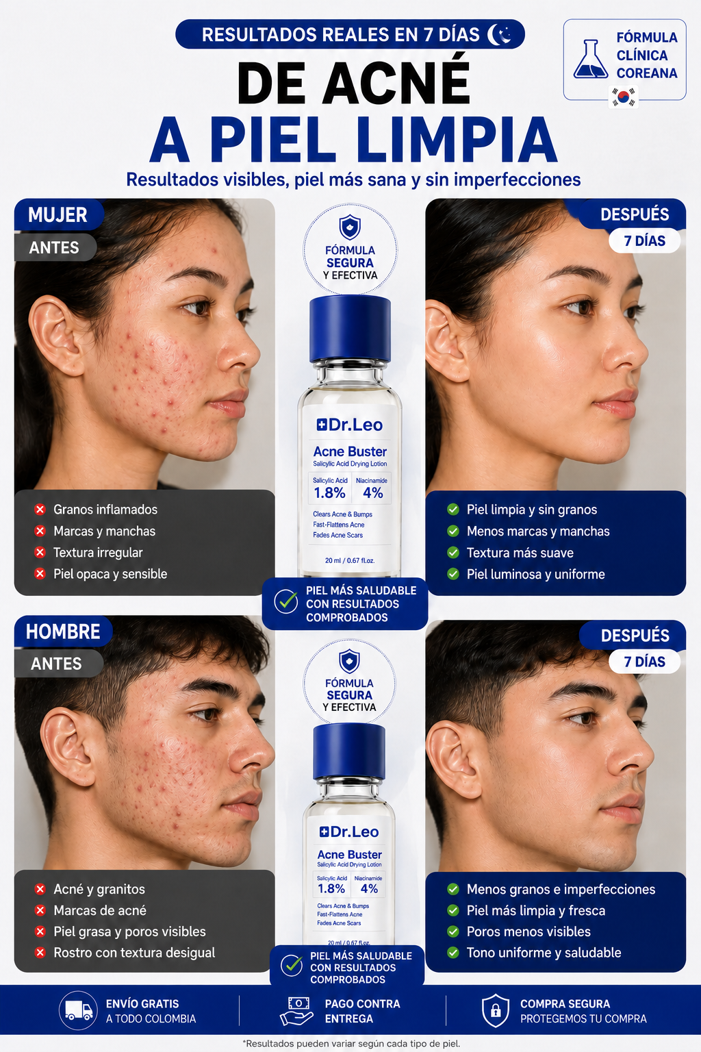 🌙 Dr. Leo Acne Buster: Acción Focalizada de Noche contra el Acne y las Imperfecciones ✨